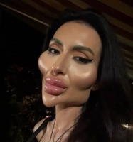 女网红为流量走极端路线，把自己整容成怪物，整容前照片被曝光