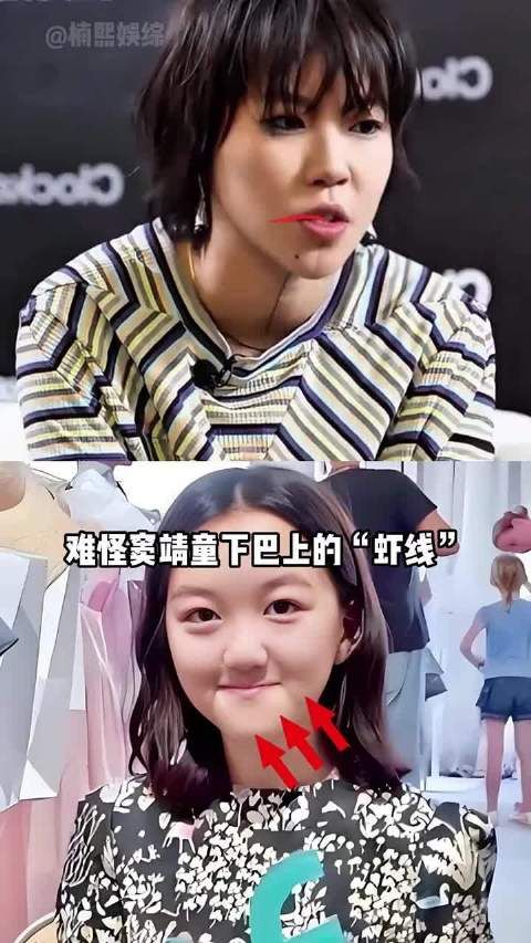 为何窦靖童的“虾线”与李嫣的“兔唇”会一同消失？