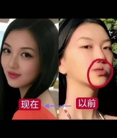 李嫣微整后神似王菲，遗传母亲清冷美艳气质