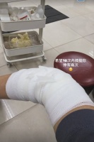 44岁前TVB女星惊爆长期病患，厚重包扎触目惊心令网友心疼，情路坎坷事业陷僵局