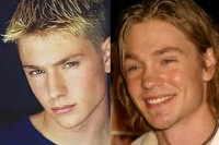 他的鼻子变丑了，反而成为了模特演员