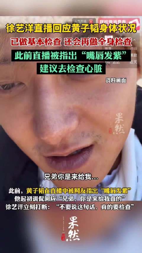 徐艺洋让黄子韬做全身检查，此前网友发现黄子韬嘴唇发紫，建议其去检查心脏