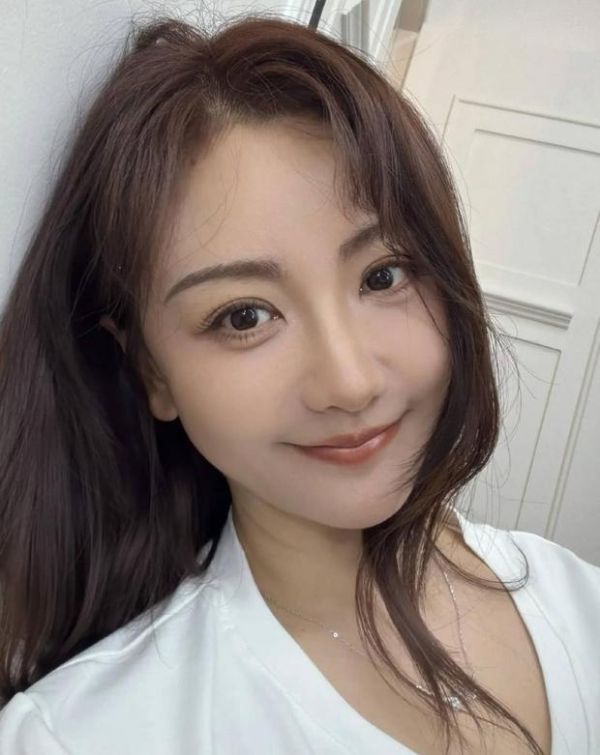 杨蓉皮肤白皙。