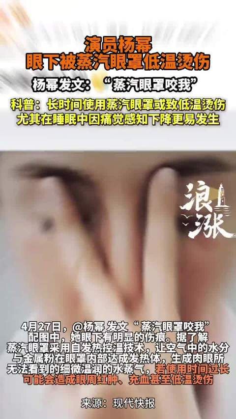 张馨予回应杨幂被烫伤