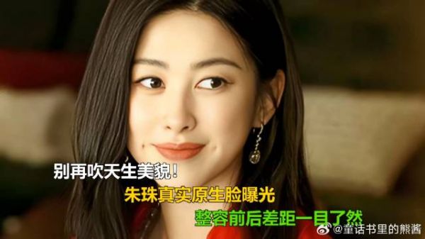 别再吹天生美貌！朱珠真实原生脸曝光，整容前后差距一目了然
