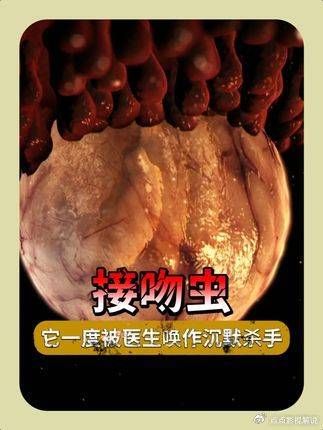 豪斯医生：脸上被“亲”后心脏停跳，这竟不是恐怖片！