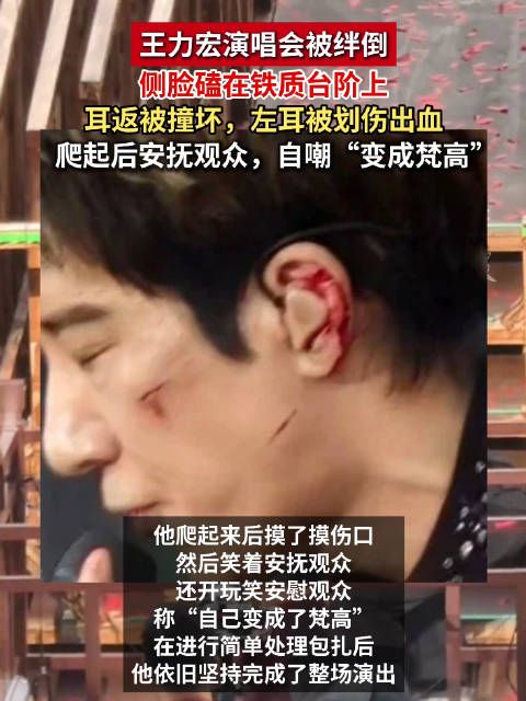 王力宏摔倒安慰歌迷自己变梵高