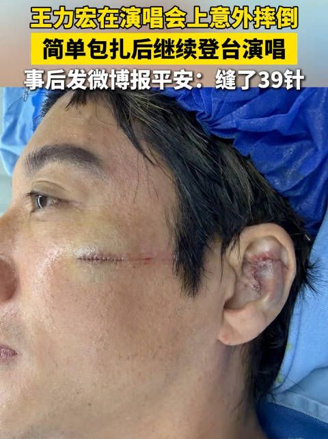 王力宏深夜发文回应受伤情况 ：CT 检查显示脑部和头骨都没有受伤，只是因为外耳软骨被撞碎才流血