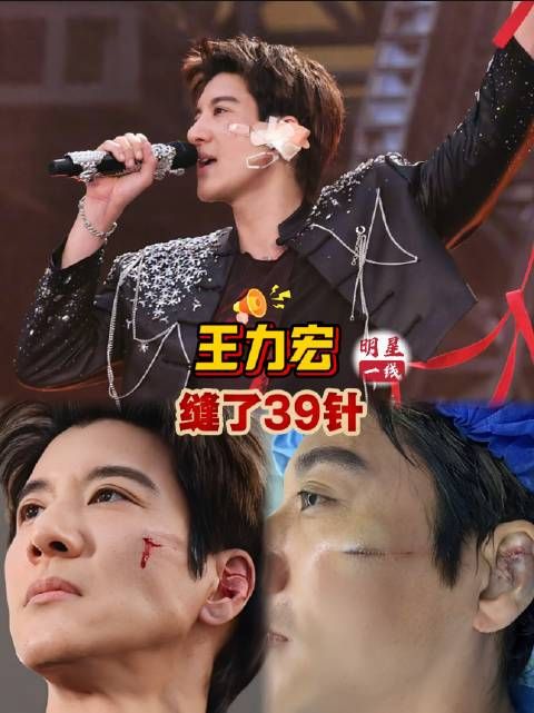 王力宏演唱会跌倒受伤缝39针，凌晨声明报平安