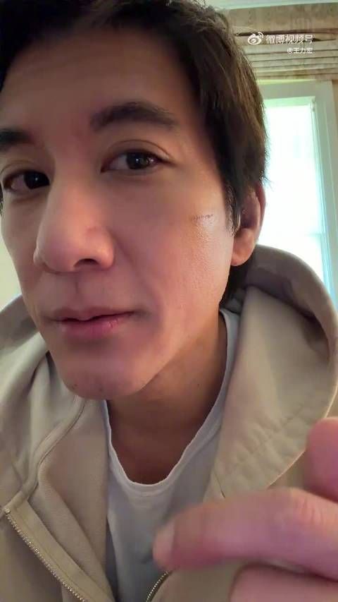 王力宏回应恢复近况：明日拆线