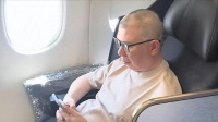 冯小刚终于老实了，被曝脑袋全是斑块，养女徐朵脸肿原因藏不住了