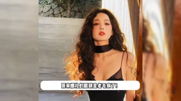 娜扎回应眼睛问题，称是小时候留下的病根，可能会考虑做手术