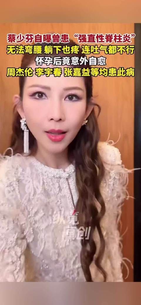 蔡少芬自曝曾患强制性脊柱炎