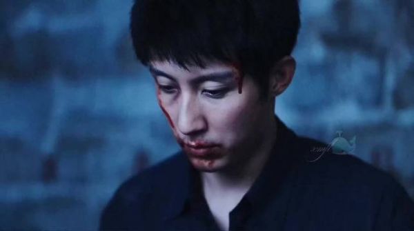 黄景瑜连续三部剧右眼受伤梅开三度