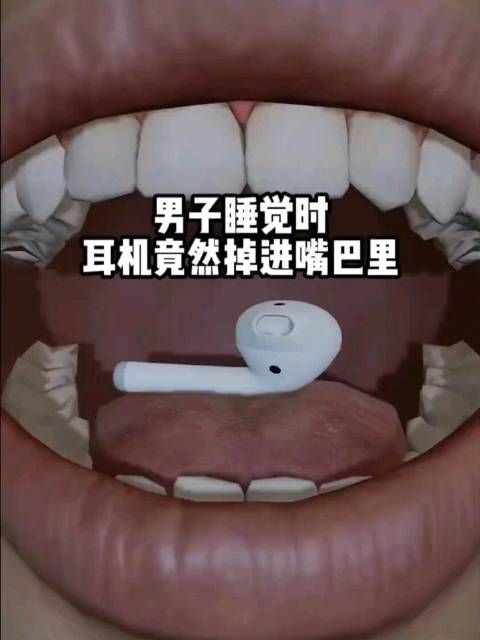 男子睡觉时，耳机竟然掉进嘴巴里 科普
