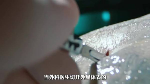 外星人来到地球缺被解刨