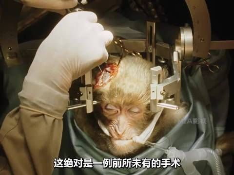 这是一场史无前例的手术！ 惊悚 高分电影 科幻