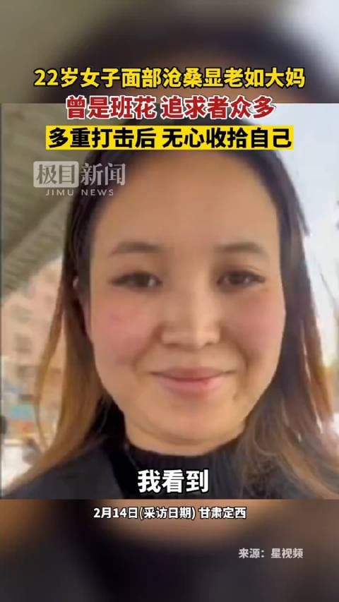 22岁女子面部沧桑显老如大妈，当事人：变成现在这个样子……