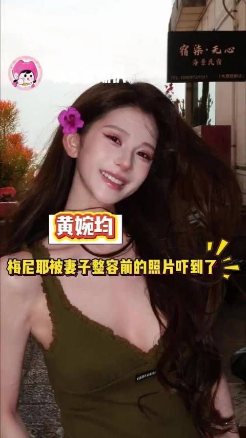 梅尼耶被妻子整容前的照片吓到了