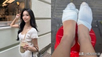 24岁港姐亚军桂林旅游遇意外，右脚踝肿得吓人，网友催她赶紧就医